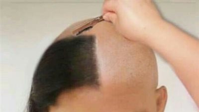 هل حلاقة الشعر بالموس مفيدة 
