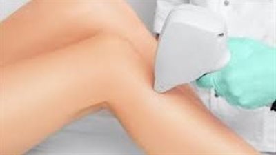 إزالة الشعر بالليزر: طريقة آمنة وفعالة