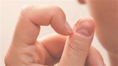 وداعاً لعادة قضم الأظافر: 5 طرق فعالة للتوقف عن أكل الأظافر
