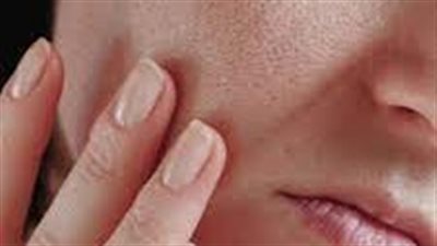 ما هي أنواع البشرة الدهنية؟