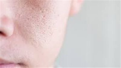 أسرع طريقة لإغلاق مسامات الوجه