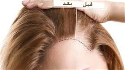 وداعاً لتساقط الشعر مع الكولاجين